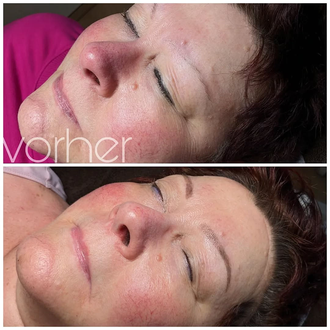 Vorher-Nachher-Bild von Powderbrows Permanent Make-up.